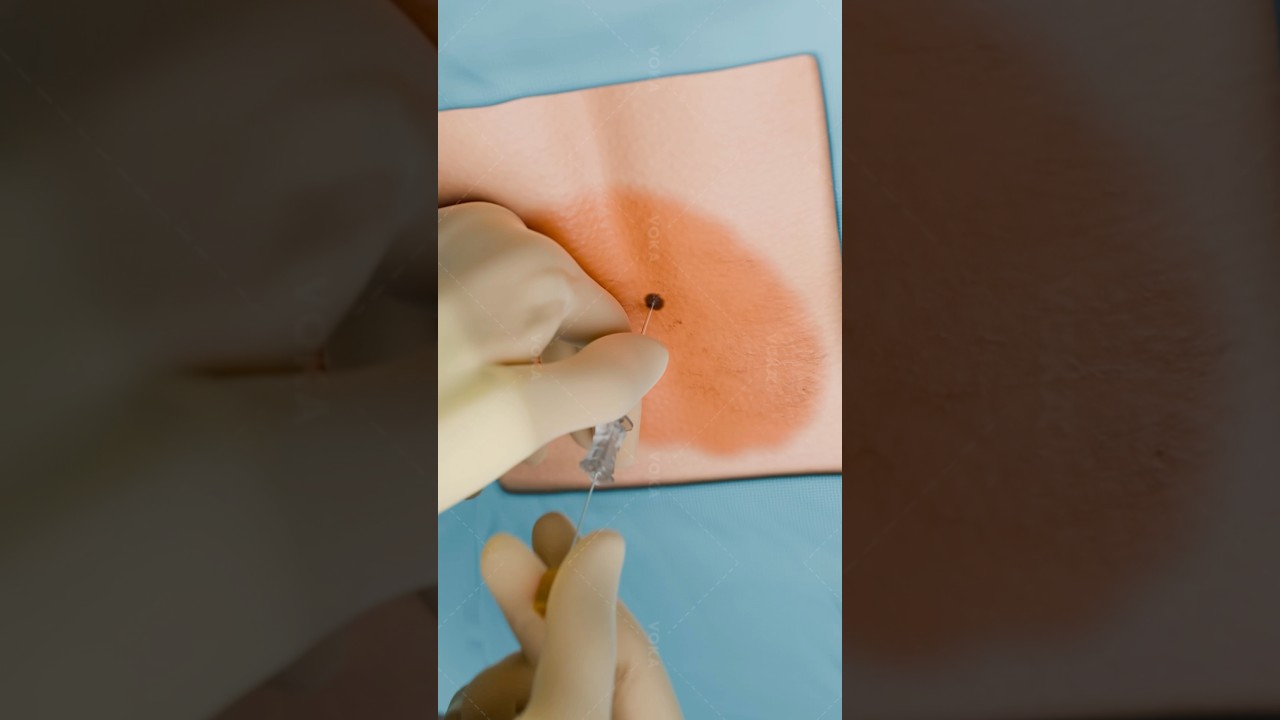 youtube placeholder image