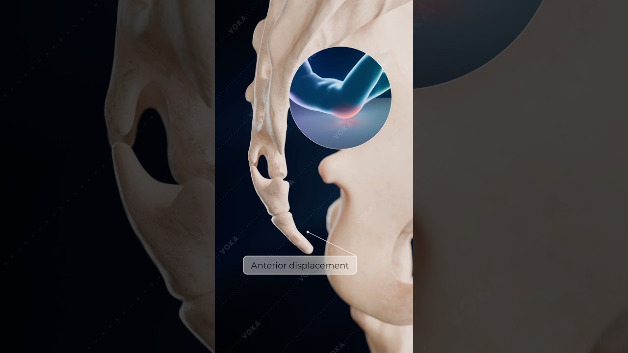 youtube placeholder image