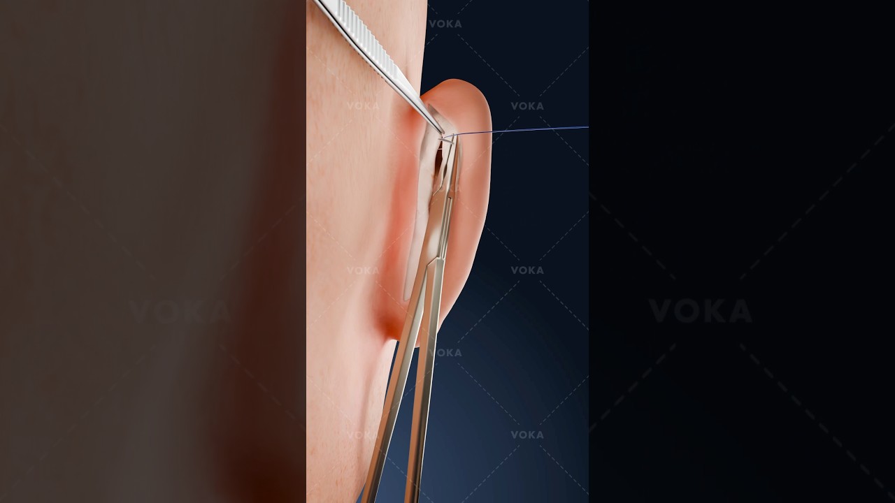 youtube placeholder image