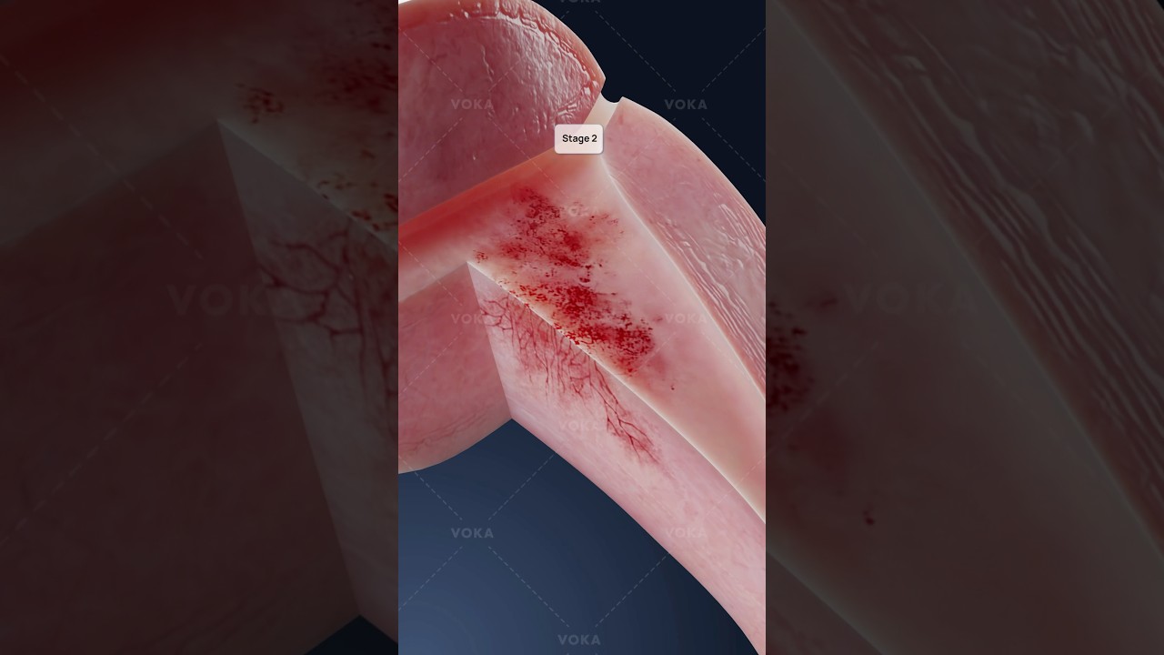 youtube placeholder image
